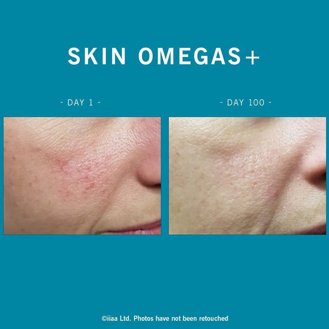 Advanced Nutrition Programme | Skin Omegas  180 caps